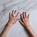 Rote Hände und ihre Ursachen